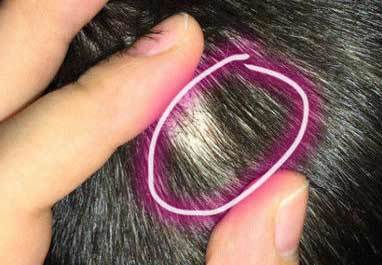 Kinh hoàng 5 cô giáo dùng kim đâm trẻ mầm non