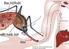 9 hiểu lầm tai hại về bệnh sốt xuất huyết