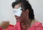 Một phụ nữ bị tạt axit giữa trung tâm Sài Gòn