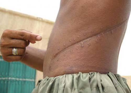 Bắt kẻ làm giả giấy tờ mua bán thận