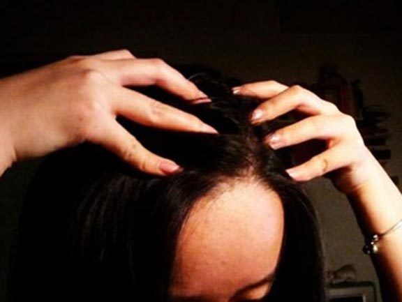 Căn bệnh chết người đang 'vào mùa': 8 điều này phải nhớ!