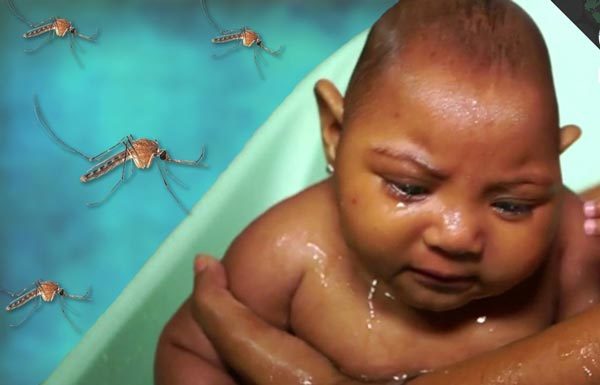 Những điều tối quan trọng nên biết về virus Zika