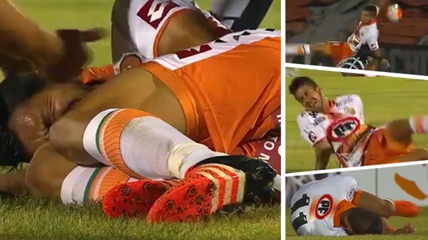 Pha va chạm khiến cầu thủ Argentina gãy gập tay