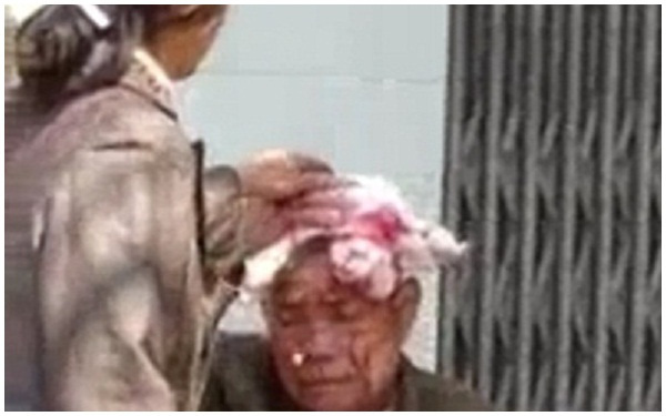 Thái Nguyên: Con dâu đánh chảy máu đầu bố chồng gây phẫn nộ