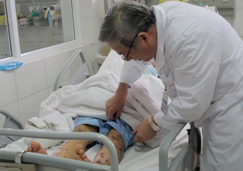 Hà Nội theo dõi 30 người sau ca viêm não mô cầu đầu tiên