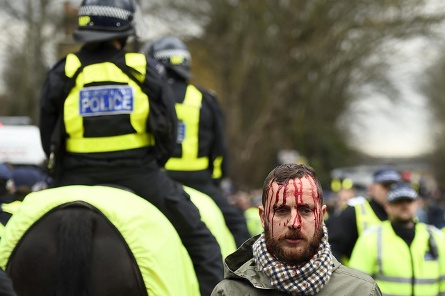 Bạo loạn đổ máu trước trận derby bắc London