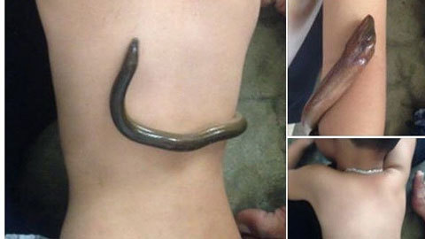 Dùng lươn sống hạ sốt cho con nguy hiểm ra sao?