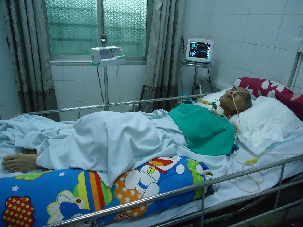 Hướng dẫn phục hồi chức năng sau tai nạn chấn thương sọ não
