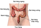 Cách kéo dài sự sống khi bị ung thư trực tràng