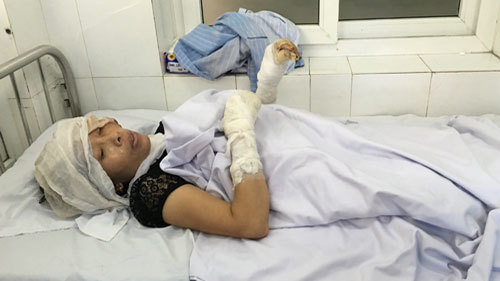 nạn nhân vụ nổ xưởng gỗ - Nghệ An