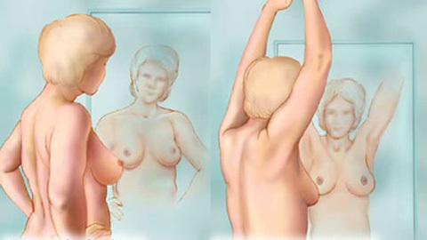 Cách sờ nắn đơn giản phát hiện sớm ung thư vú