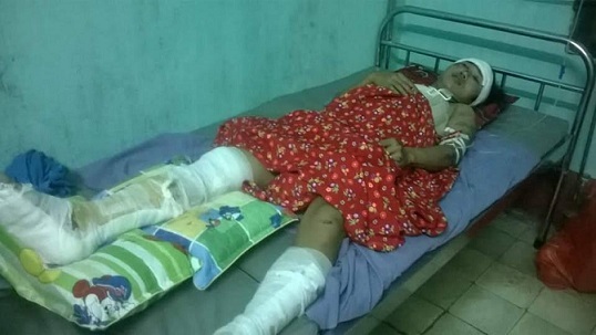 Cha tàn tật nuốt nước mắt chăm con bị tai nạn giao thông