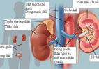 Đừng đối xử 'tệ' với thận!