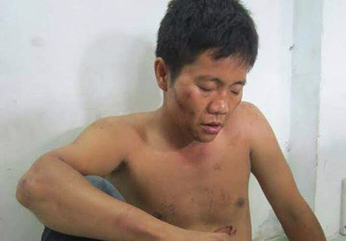 Cảnh sát nổ súng bắt 2 tên cướp nguy hiểm ở Sài Gòn