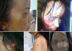 Nghi vấn chồng cũ bạo hành vợ dã man ở Phú Thọ