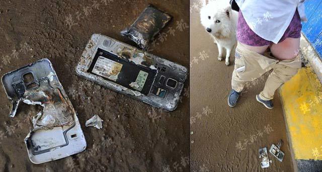 Bỏng đùi vì điện thoại cháy trong túi quần