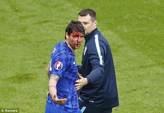 Corluka bị chảy máu