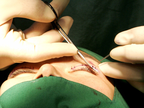 Ký ức đau đớn của ca sĩ Việt chuyển giới trên đất Thái