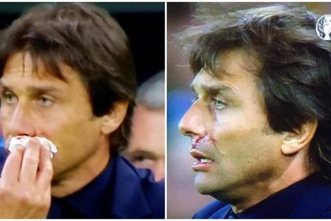 HLV Conte tóe máu mũi vì ăn mừng quá lố