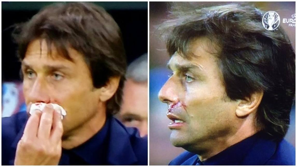 HLV Conte tóe máu mũi vì ăn mừng quá lố