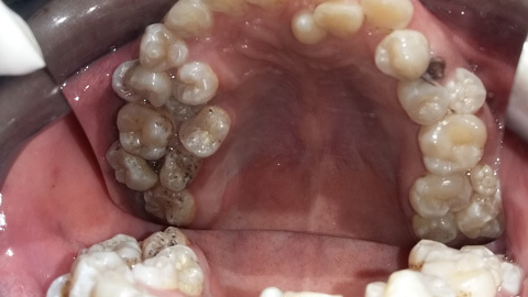 Hy hữu: Răng mọc tua tủa trong miệng chàng trai 28