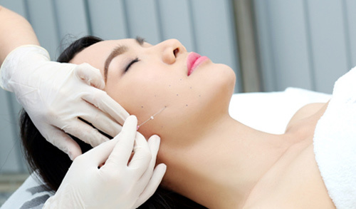 Căng da không phẫu thuật bằng chỉ vàng