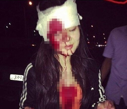 Ôm ấp bạn trai trên ô tô: Hotgirl nhận cái kết kinh hoàng
