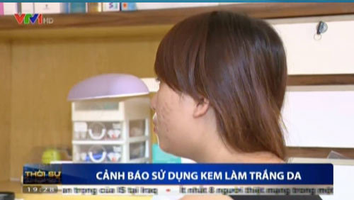 3 biến chứng khó lường từ kem tẩy trắng da