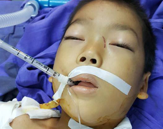 Bố tự tử sau khi chém con nguy kịch