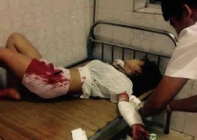 Đi thăm người yêu, nữ sinh bất ngờ rạch tay tự sát