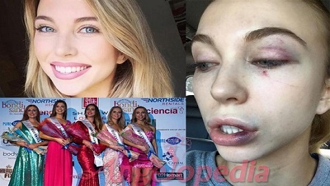 Thí sinh Hoa hậu bị 4 phụ nữ đánh hội đồng dã man