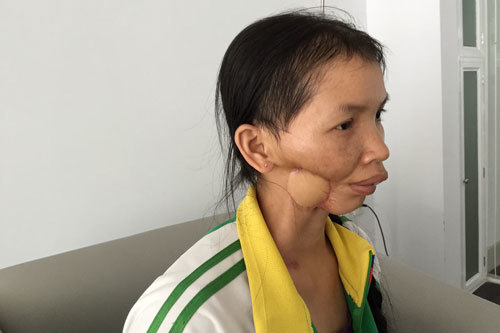 Chồng bị sét đánh chết, vợ ung thư con nhỏ nheo nhóc