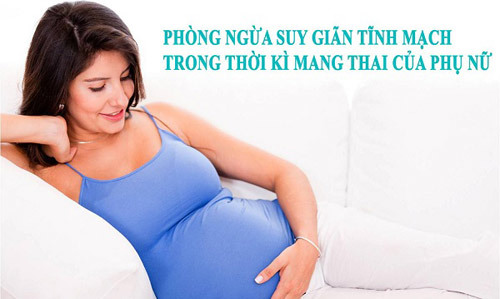 Giãn tĩnh mạch chân ‘đe dọa’ phái đẹp