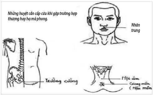 Thượng mã phong, trạng thái nguy hiểm khi 'yêu'