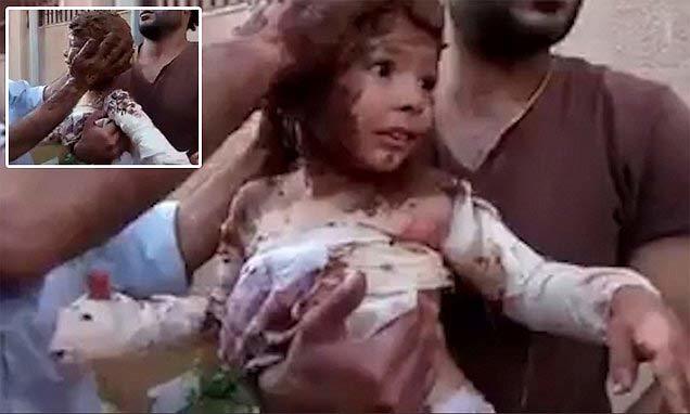 Xót xa cảnh dùng bùn chữa bóng cho bé gái Syria bị trúng bom