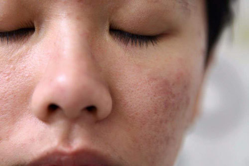 ‘Điểm trừ’ trong quy trình dưỡng da của người Hàn