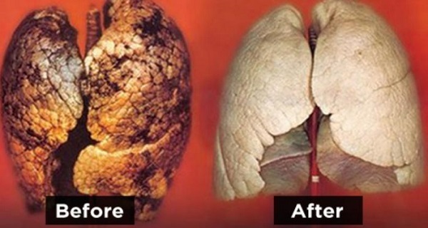 Ngừa ung thư phổi, detox chỉ 3 ngày