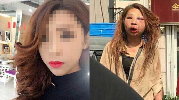 Hotgirl xinh như mộng bị đánh tàn tạ ném bên đường gây sốc?