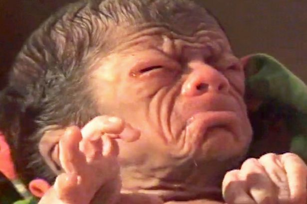 Bé trai mới lọt lòng đã già như ông cụ 80