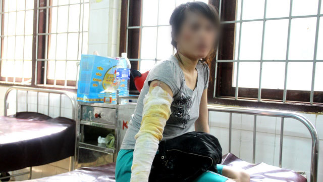 Bị chồng tạt nước sôi vì tự ý đi… làm đẹp