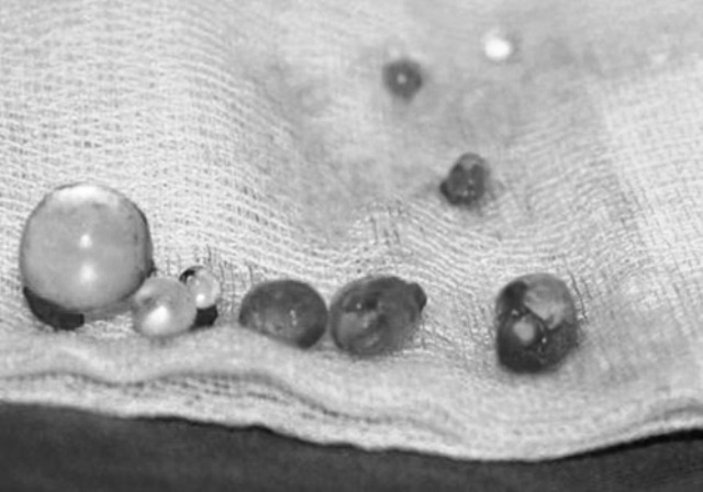 Ngư dân gặp họa khi nâng cấp 'súng' giữa biển