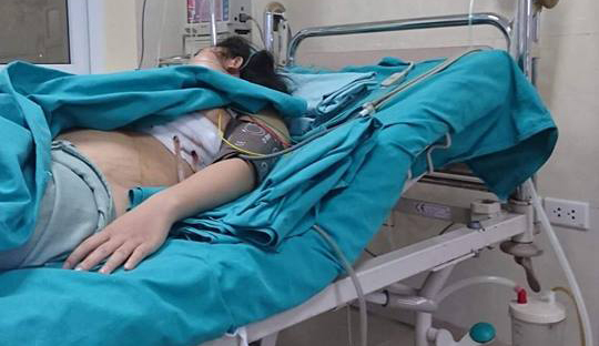 Người phụ nữ đi đường bị đoạn sắt găm sâu vào ngực