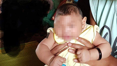 Bé gái VN đầu tiên dị tật đầu nhỏ nghi nhiễm Zika
