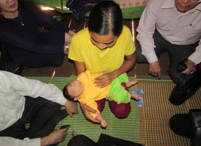 Đắk Lắk:  Phát hiện 3 trẻ bị chứng đầu nhỏ