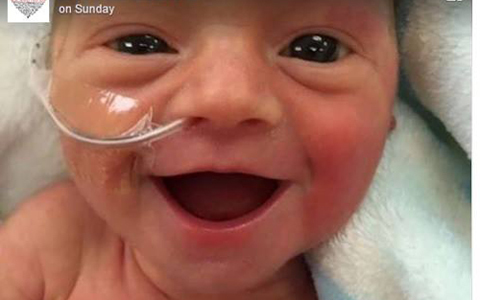 Nụ cười bừng sáng của cô bé sinh non nặng hơn 1 kg