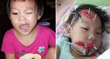 Mẹ tá hỏa phát hiện con bị méo miệng, liệt mặt chỉ sau 1 đêm trời trở gió