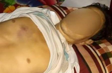 Vụ chết khi từ trụ sở công an về: Triệu tập công an xã