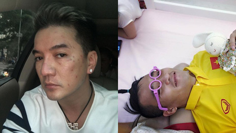 Mr Đàm lộ da mặt xấu tệ, Công Vinh giả làm mẹ chăm búp bê