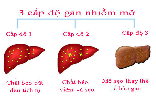 Ăn chay trị gan nhiễm mỡ: Tác dụng ngược