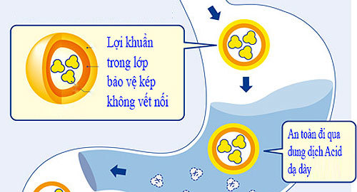 Bí quyết thoát ‘án chung thân’ viêm đại tràng
